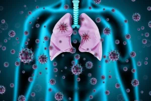 Read more about the article Clinical recommendations for the inpatient management of lower respiratory tract infections in children and adolescents with severe neurological impairment