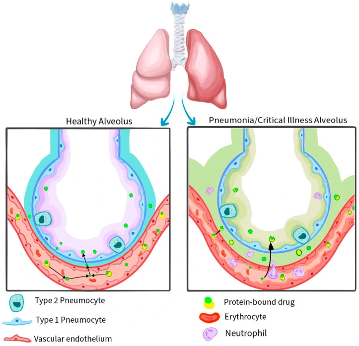 pharmacokinetic-pharmacodynamic-parameters-of-antibiotics-between-normal-alveoli-and-critical-illness