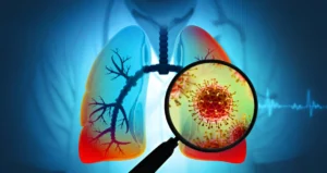 Read more about the article Current role of ceftobiprole in the treatment of hospital acquired and community acquired pneumonia: expert opinion based on literature and real-life experiences