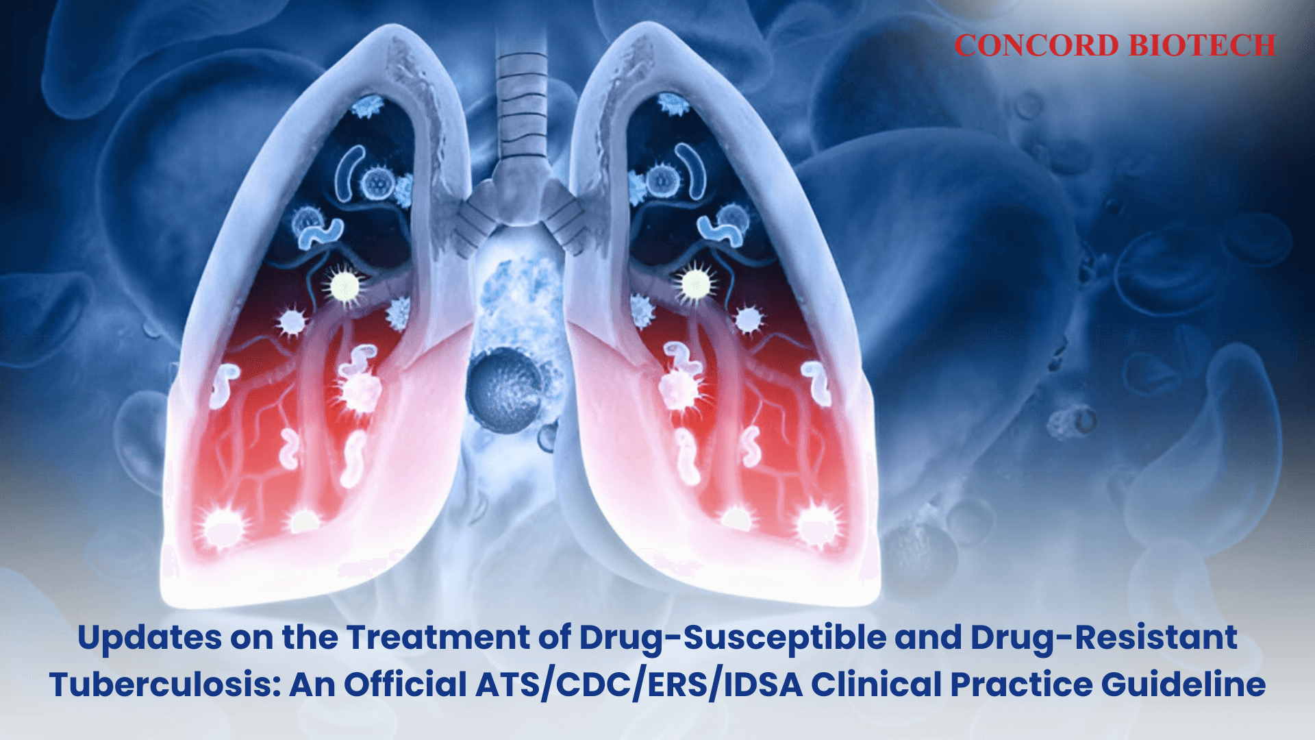 Updates on the Treatment of Drug-Susceptible and Drug-Resistant ...