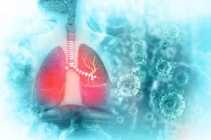 Read more about the article Nosocomial lower respiratory tract infections in patients with immunosuppression: a cohort study